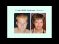 Prader-Willi Syndrome - CRASH! Medical Review Series