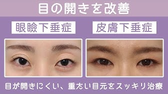 目整形 Youtube