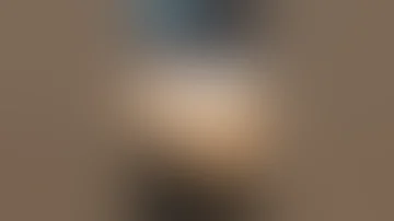 Butt Augmentation Using Fat Grafting And Result Brazilian Butt Lift In Delhi Shortfeed Shorts 