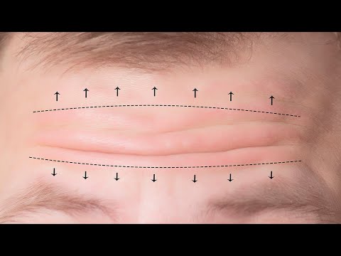 How To Reduce And Prevent Forehead Wrinkles Naturally