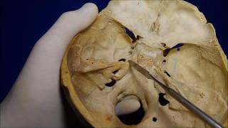 Base Del Cráneo Vista Superior