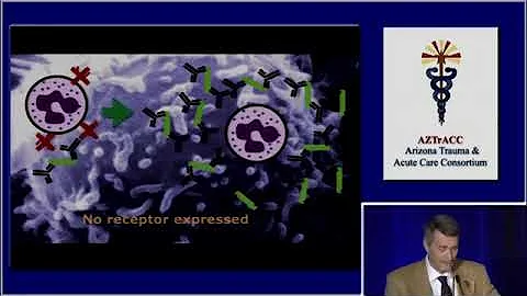 Immunological Response after Multitrauma, presente...