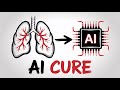 AI Discovered a Cure Doctors Missed for 50 Years