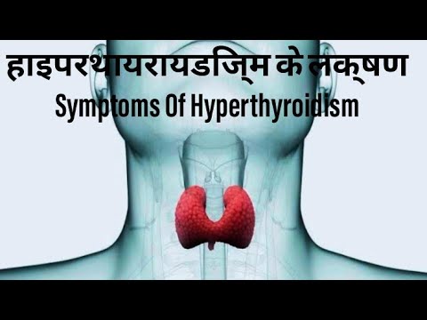 हाइपरथॉयराइडिज्म के लक्षण (Symptoms of Hyperthyroidism in Hindi)