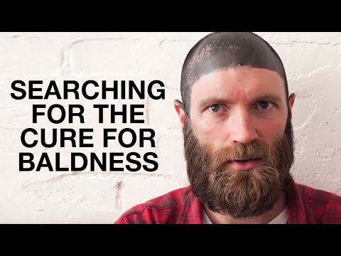 baldness cures