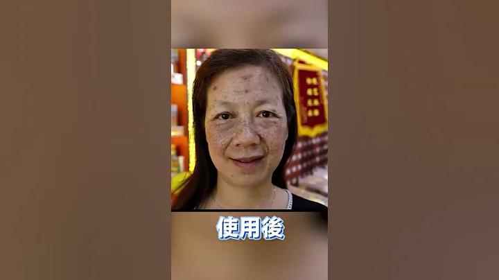 吳明珠研製【吳氏中藥淡斑霜】 - 天天要聞