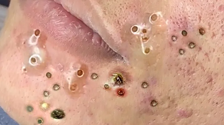 𝑨𝒄𝒉𝒊𝒆𝒗𝒆 𝑰𝒏𝒏𝒆𝒓 𝑷𝒆𝒂𝒄𝒆 𝑾𝒊𝒕𝒉 𝑻𝒉𝒆𝒔𝒆 𝑭𝒂𝒄𝒊𝒂𝒍 𝑪𝒍𝒆𝒂𝒏𝒔𝒊𝒏𝒈 𝑴𝒆𝒕𝒉𝒐𝒅𝒔 #901226108