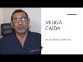 VEJIGA CAIDA  DR. SIVIARDO DE LEÓN JAÉN