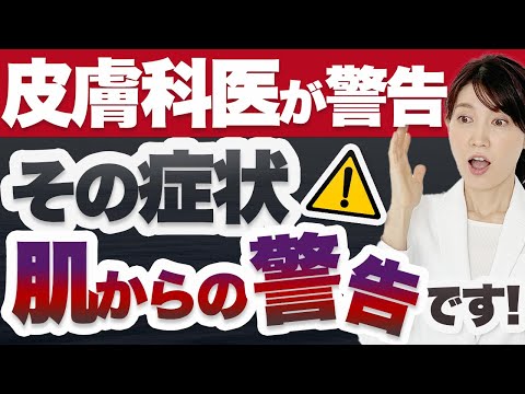 皮膚の好転反応について解説します