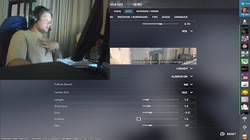 S1mple settings for CS2