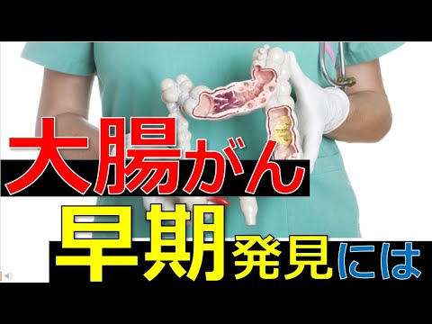 【大腸がん】早期発見のために知っておきたいこと