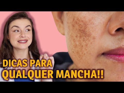 Vídeo: 3 maneiras de tratar o eczema no rosto