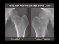 Imaging of the Hip: More Radiographic Essentials!