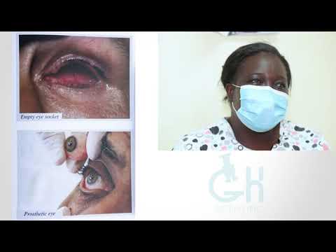 The Home of Prosthetic Eyeballs - Evelyn Kyereh (Evolution of Science)