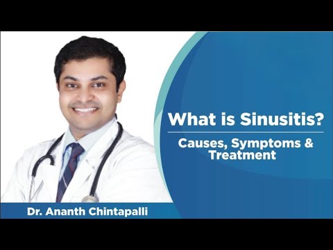 Video: Sinusitis: Symptomen, Behandeling, Wat Is Het, Microbiële Code 10, Tekenen