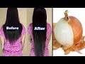 How To Grow Long and Thicken Hair Faster With Onion! Super Fast Hair Growth Challenge!