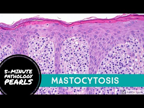 Video: Mastselgewas (Mastocytoma) By Honde