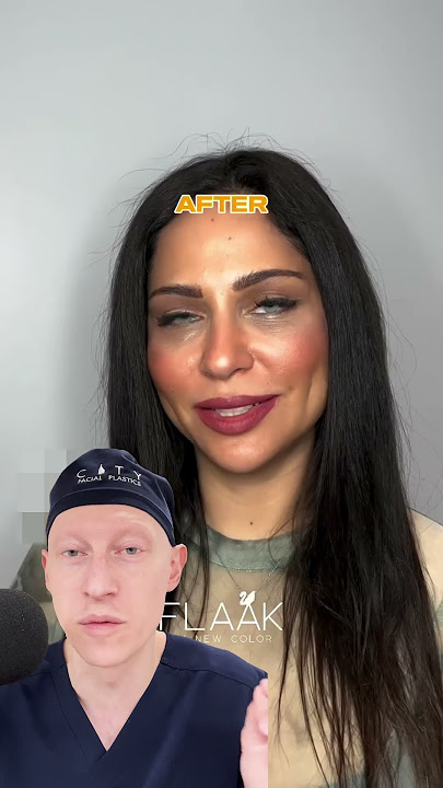 BEWARE These Eye Color Changing Procedures...