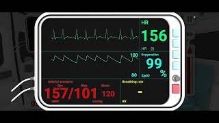 Asystole - Reanimation Inc #kirkiimad #reanimationinc #itlosesitsbounce