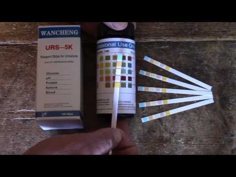 Bayer Urine Test Strips Color Chart