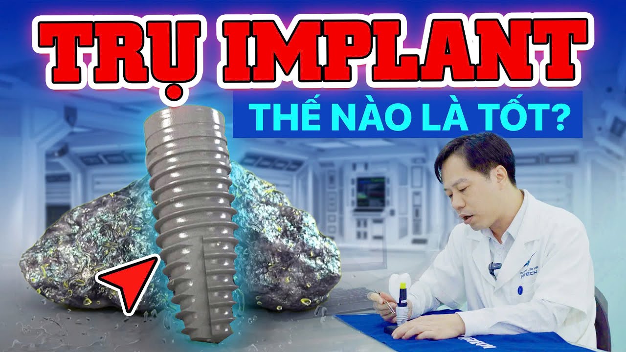 Outline Video Thế Nào Là Trụ Implant Tốt? Hướng Dẫn Chọn Trụ Implant Chuẩn Nhờ 2 Tiêu Chí Quan Trọng