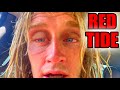 I Almost Went Blind While Surfing (The Truth About Red Tide)