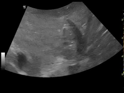 ultrasonography: liver of a dog with gas bubbles in portal veins
