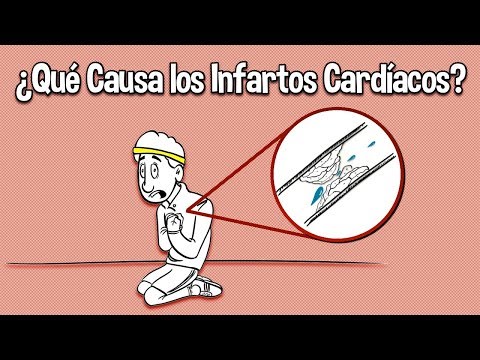 Vídeo: ¿Cómo Se Siente Un Ataque Al Corazón? 14 Síntomas