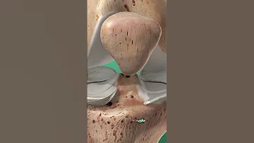 Did Orthopedics Make A Huge Mistake 
