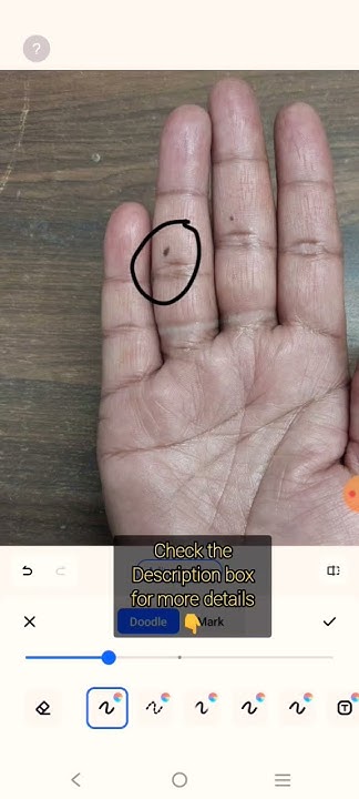 meaning-of-mole-on-2nd-phalange-of-sun-finger-in-palmistry-palmistry