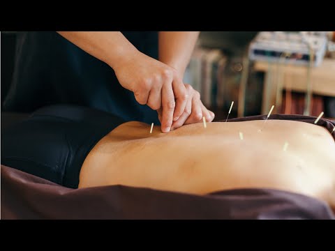 Acupuncturists Career Video
