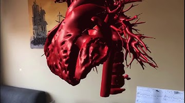 Beating Heart in Augmented Reality with RadHA app ARKit version
