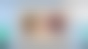 The Total Package DMEK + Phacoemulsification with PCIOL insertion