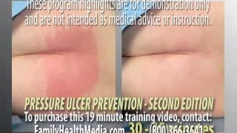 Pressure Ulcer Prevention