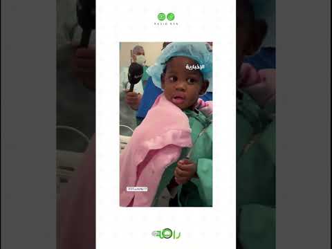 لحظة مؤثرة دخول التوأم السيامي الجامايكي أزاريا وأزورا لغرفة العمليات