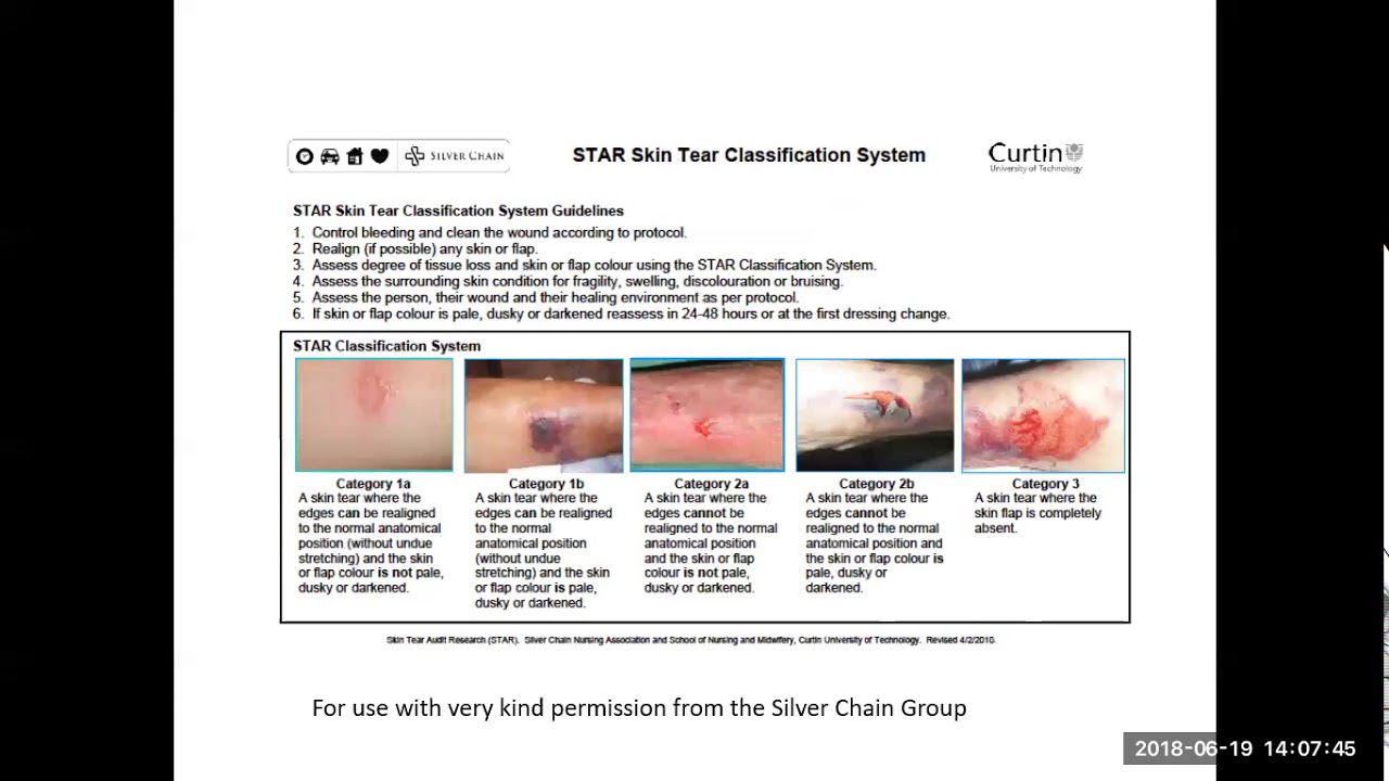 Skin Tears YouTube Skin Tears YouTube