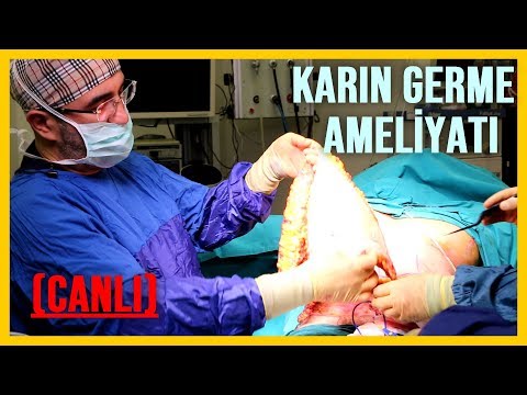 Karın Germe Ameliyatı (CANLI)😷😷😱