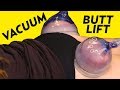 Vacuum Butt Lift? A Cellulite Treatment to Get a Big Booty! | The SASS with Susan and Sharzad