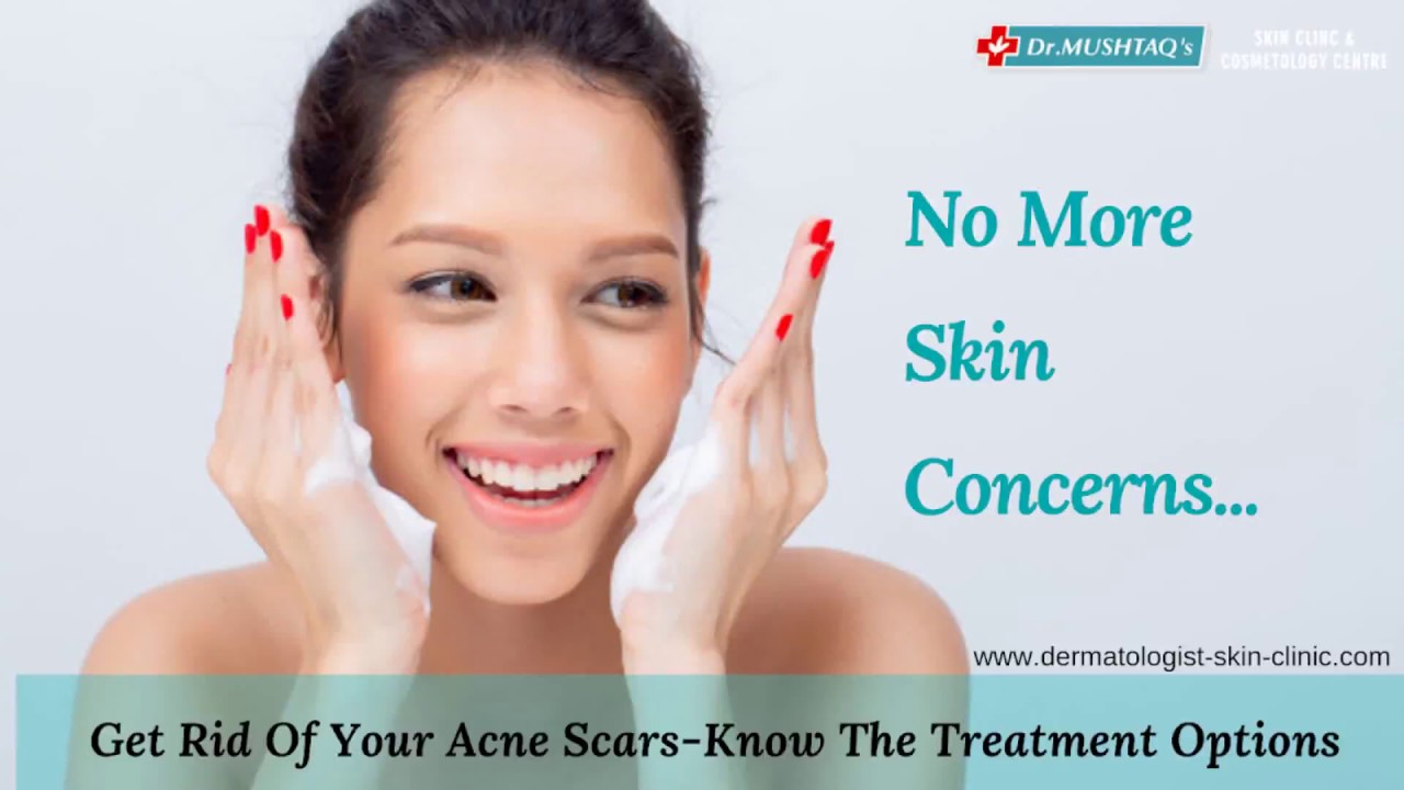 Get Rid Of Your Acne Scars Acne Treatment In Kochi Get Clear And
