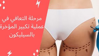 مرحلة التعافي في عملية تكبير المؤخرة بالسيليكون