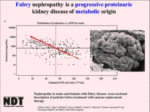 Fabry Disease. A Diagnostic Challenge for the Nephrologist (?).