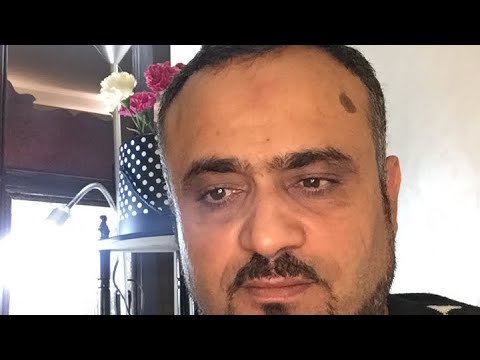 الخدار او التغفيق او النوم القسري سؤال من المنصة النفسية