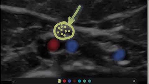 Midline - USM Diagram breakdown.MP4