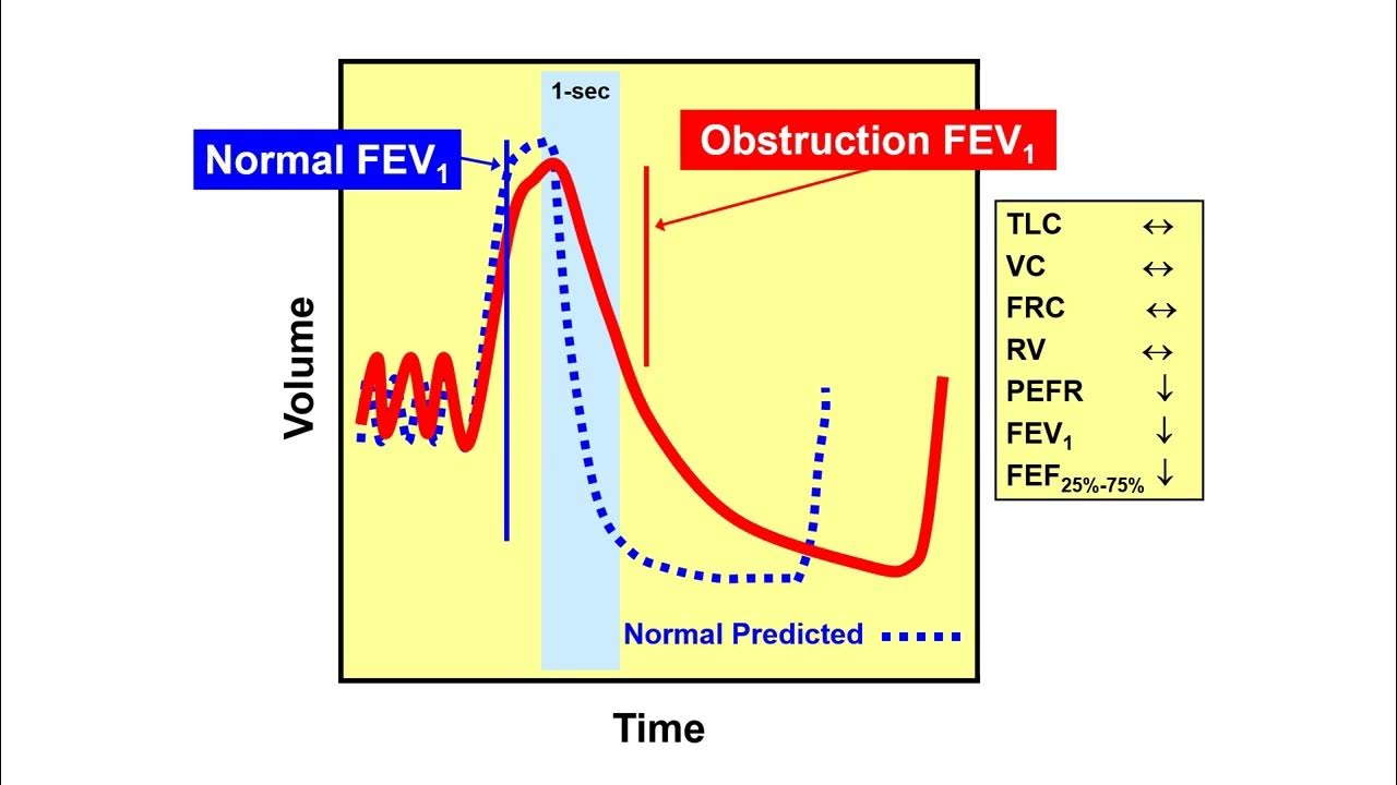 Pulmonary Function Testing Maximal Expiratory Flow Rates YouTube