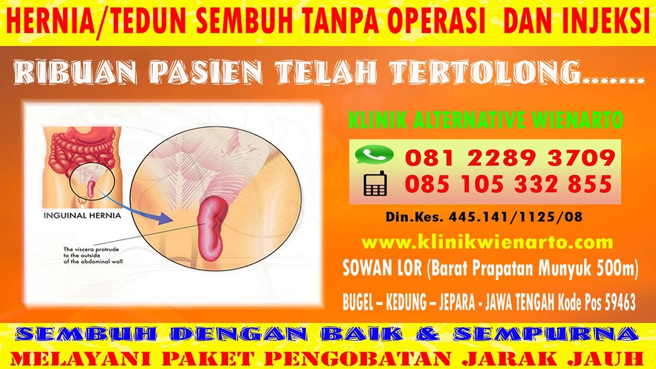Cara Mengobati dan Menyembuhkan Hernia Hiatal 