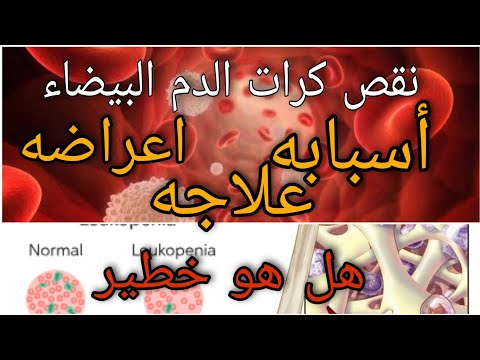 نقص كرات الدم البيضاء هل هو خطير اسبابه أعراضه علاجه متي يجب زيارة الطبيب