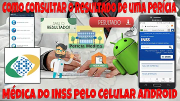 Como ver o resultado da perícia?