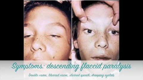 Home Canning and Botulism