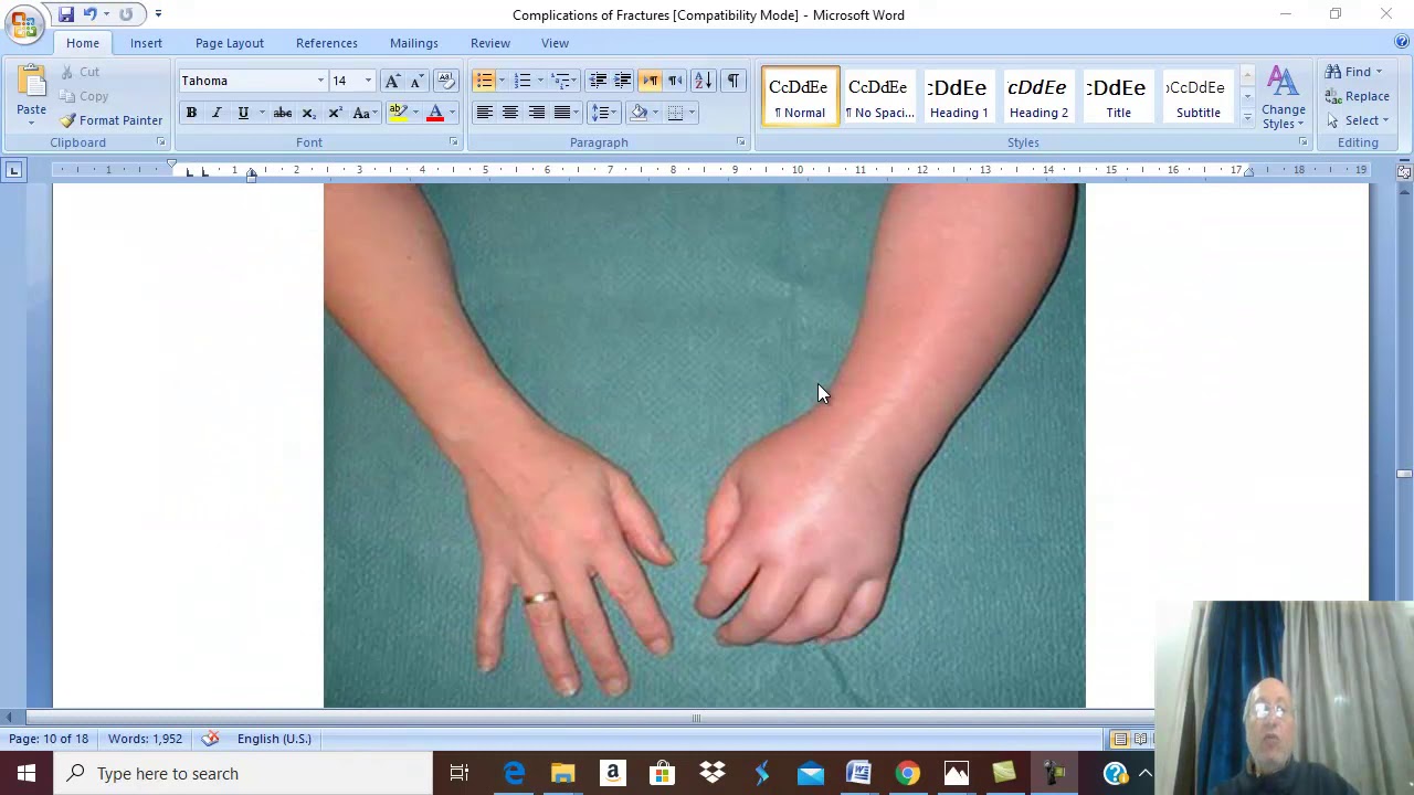 Orthopedic in Arabic 8 (  Complications of fractures , part 3 ) , by Dr. Wahdan .