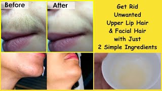 Remove Upperlip Hair &amp; Unwanted facial hair using 2 simple ingredients at home
